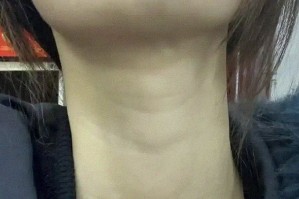 요즘 피부 상태
