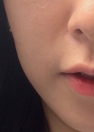 요즘 피부 상태