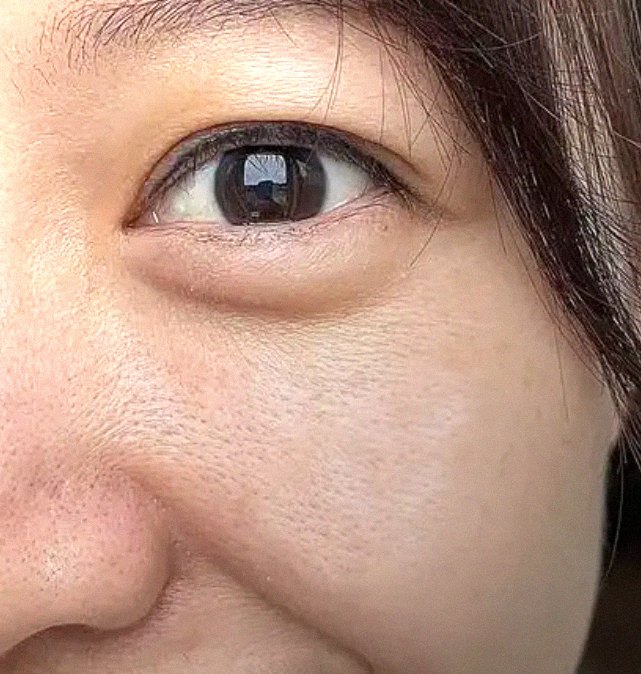 요즘 피부 상태