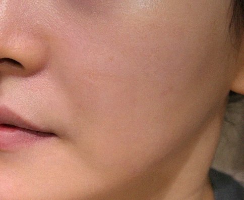 요즘 피부 상태