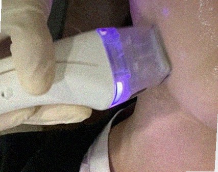 요즘 피부 상태
