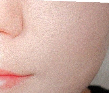 요즘 피부 상태