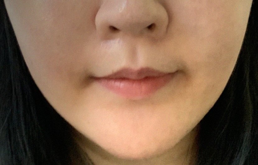 요즘 피부 상태