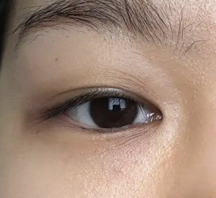 요즘 피부 상태