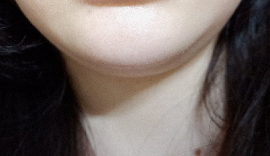 요즘 피부 상태