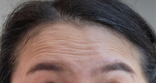 요즘 피부 상태