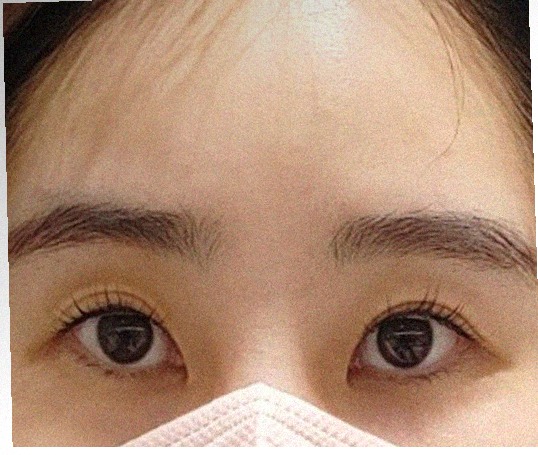 요즘 피부 상태