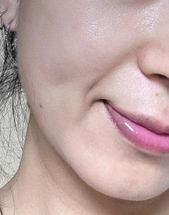 요즘 피부 상태