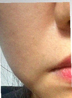 요즘 피부 상태