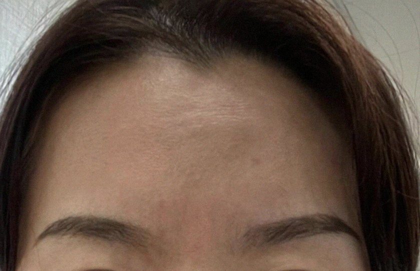 요즘 피부 상태