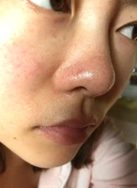 요즘 피부 상태