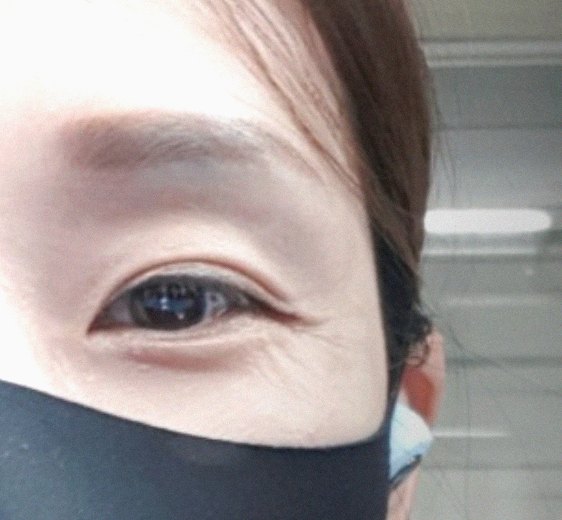요즘 피부 상태