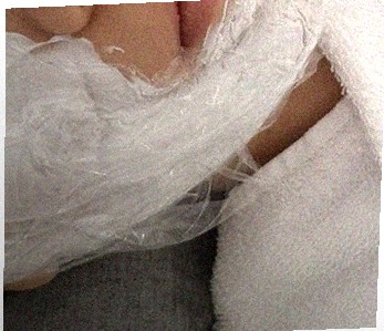 요즘 피부 상태