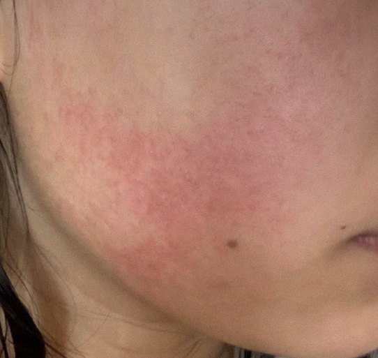 요즘 피부 상태