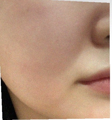 요즘 피부 상태