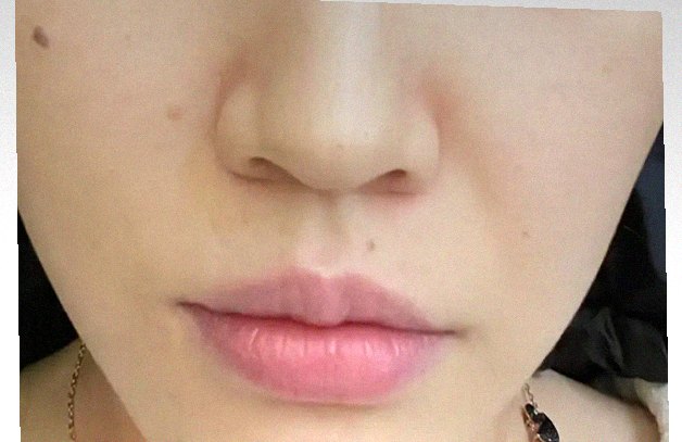 요즘 피부 상태