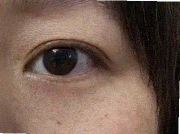 요즘 피부 상태
