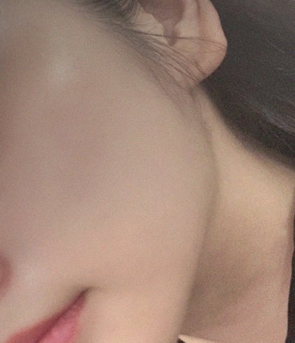 요즘 피부 상태