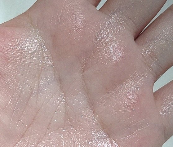 요즘 피부 상태