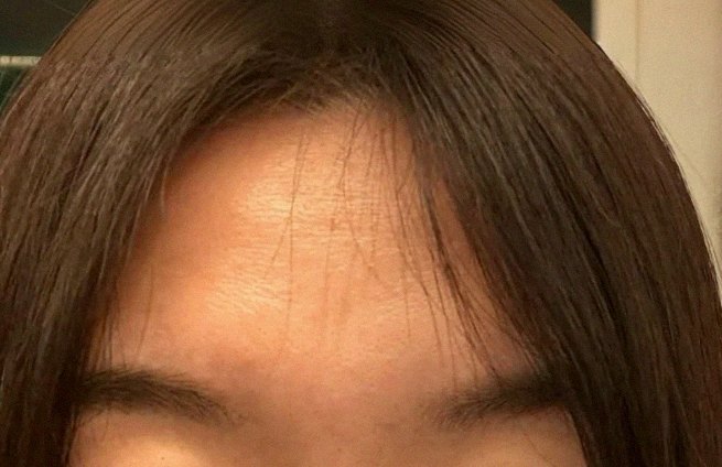 요즘 피부 상태