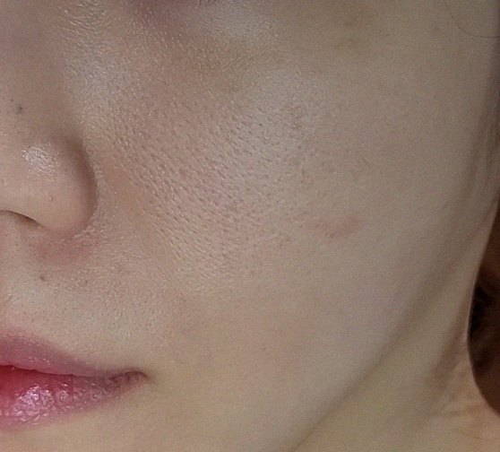 요즘 피부 상태